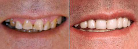 Charlestown Dental Care - Gold Coast Dentists 4