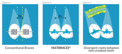 Honeysuckle Dental - Gold Coast Dentists 5