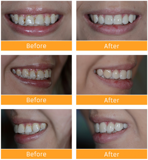 Honeysuckle Dental - Gold Coast Dentists 8