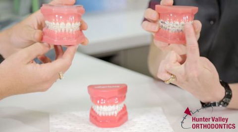 Hunter Valley Orthodontics - Gold Coast Dentists 108