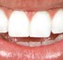 Bendigo Dentist On Hargreaves - Gold Coast Dentists