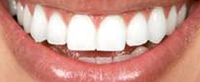 Bendigo Dentist On Hargreaves