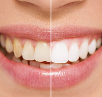All About Smiles Kincumber - Gold Coast Dentists