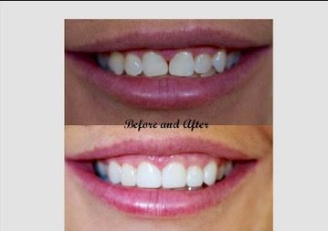 A Plus Family Dental - Gold Coast Dentists 9