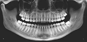 Terrigal Dental - Gold Coast Dentists 3