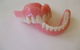 Complete Denture Solutions - thumb 2