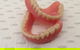 Complete Denture Solutions - thumb 3