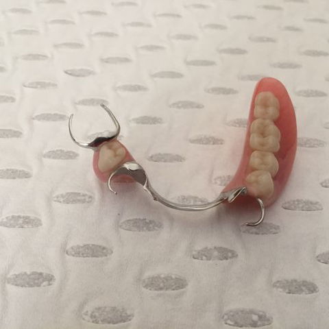 Complete Denture Solutions - Gold Coast Dentists 4