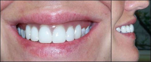 Active Denture Clinic - Gold Coast Dentists 6