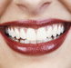 Rosenthal Dental Surgery - Gold Coast Dentists