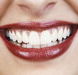 Rosenthal Dental Surgery - Gold Coast Dentists