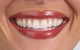 It's Your Smile - thumb 1