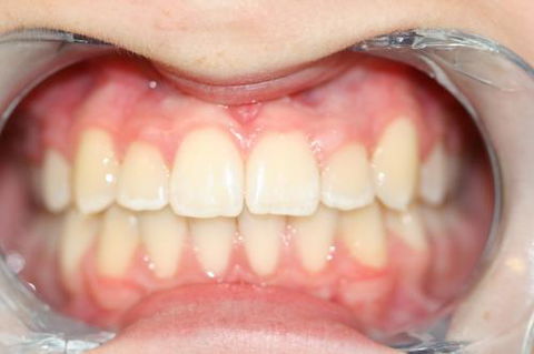 Kelaher Tony Dr - Gold Coast Dentists 5