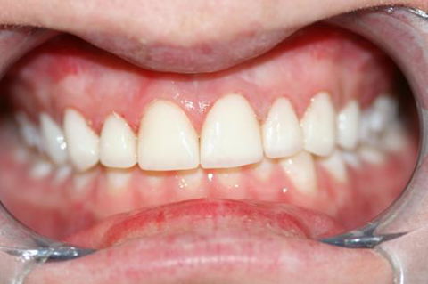 Kelaher Tony Dr - Gold Coast Dentists 7