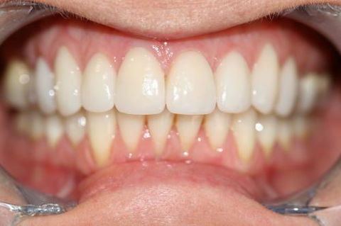 Kelaher Tony Dr - Gold Coast Dentists 9