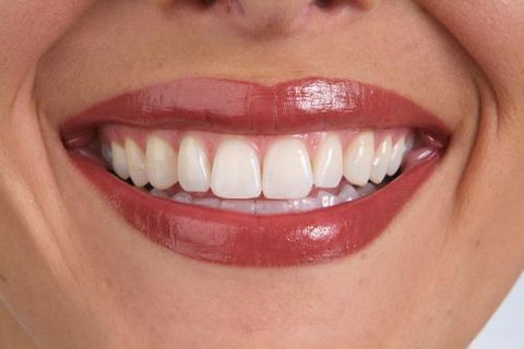 It's Your Smile - Gold Coast Dentists 5