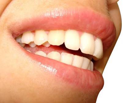 Affordable Dental Care - Gold Coast Dentists 20