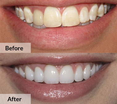 South Coast City Dental - Gold Coast Dentists 3
