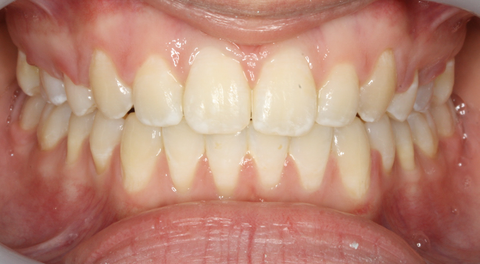 Tamworth Orthocare - Gold Coast Dentists 1