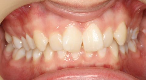 Tamworth Orthocare - Gold Coast Dentists 2