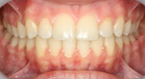 Tamworth Orthocare - Gold Coast Dentists 3