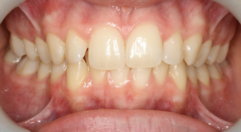 Tamworth Orthocare - Gold Coast Dentists 4