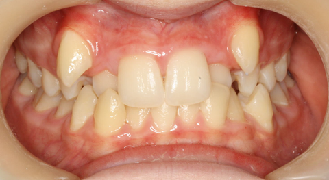 Tamworth Orthocare - Gold Coast Dentists 8