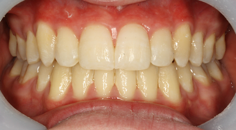 Tamworth Orthocare - Gold Coast Dentists 13