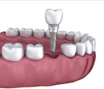 Smiles Nambour - Gold Coast Dentists 7