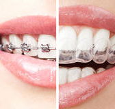 The White Bite - Gold Coast Dentists