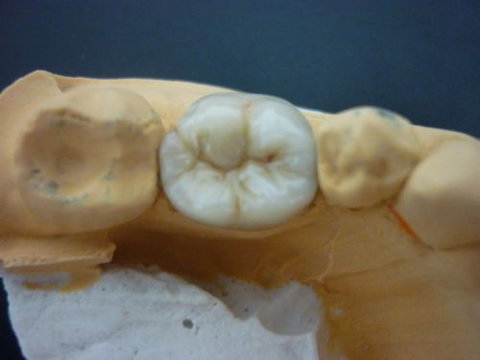 M A Dental Ceramics - Gold Coast Dentists 0