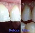 Rien Dental - Gold Coast Dentists