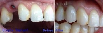 Rien Dental - Gold Coast Dentists 0