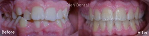 Rien Dental - Gold Coast Dentists 1