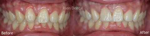 Rien Dental - Gold Coast Dentists 2