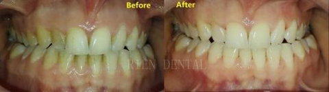 Rien Dental - Gold Coast Dentists 3