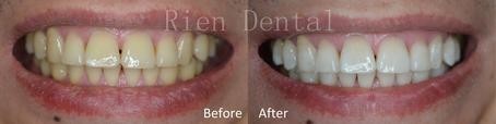 Rien Dental - Gold Coast Dentists 5
