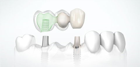 Park Terrace Dental - Dr Damian Chung - Port Lincoln - Gold Coast Dentists 7