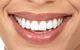 Smile Professionals - Reliable Cosmetic Dentistry In Perth - thumb 0