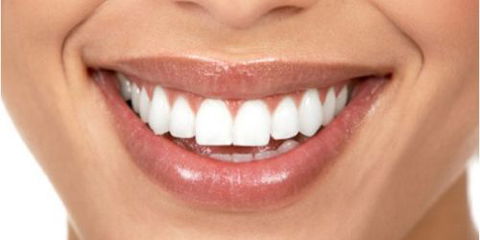 Smile Professionals - Reliable Cosmetic Dentistry In Perth - Gold Coast Dentists 0