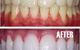Smile Professionals - Reliable Cosmetic Dentistry In Perth - thumb 1