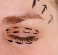 Queensland Plastic Surgery - Gold Coast Dentists