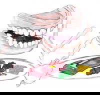 Dannalees Mobile Denture Service - Gold Coast Dentists