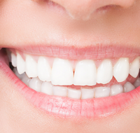 MS Dental Cardiff - Gold Coast Dentists