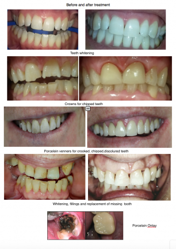 Smile Craft Dental - Gold Coast Dentists 1