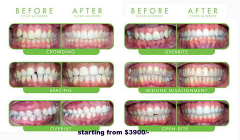 CUMULUS DENTAL - Gold Coast Dentists 7