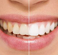 Newcastle Dental Care - Gold Coast Dentists