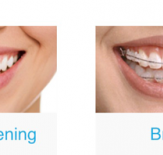 Smile Street Murwillumbah - Gold Coast Dentists