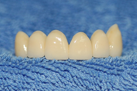 Watkins Dental - Gold Coast Dentists 4