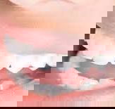 Ramana HarryDental Prosthetist - Gold Coast Dentists